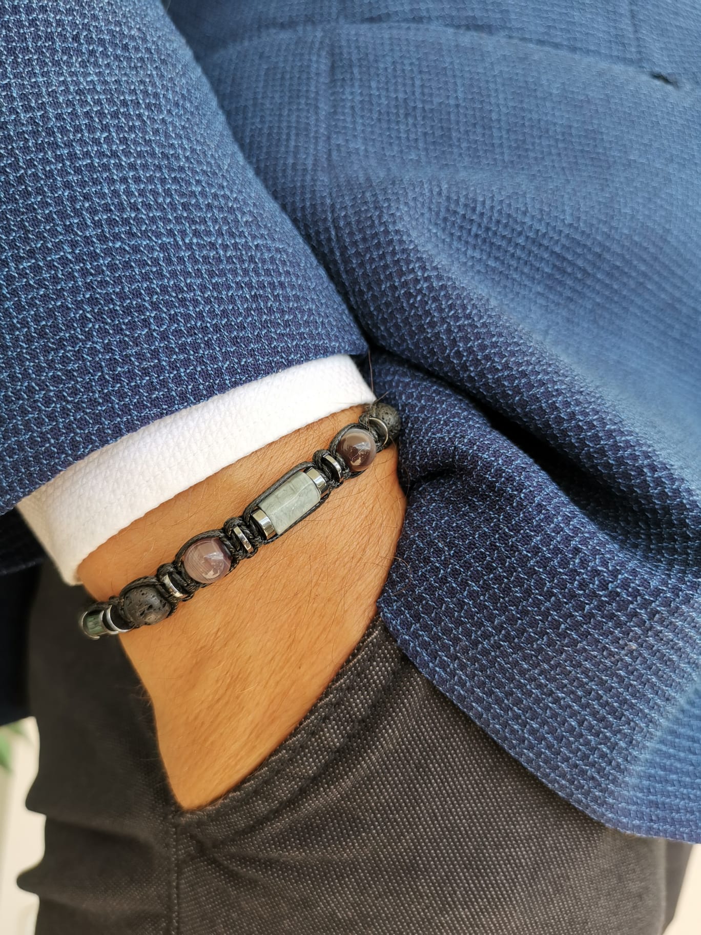 215 The Hawk’s Vision